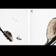 Microscope images of the patient’s lice.